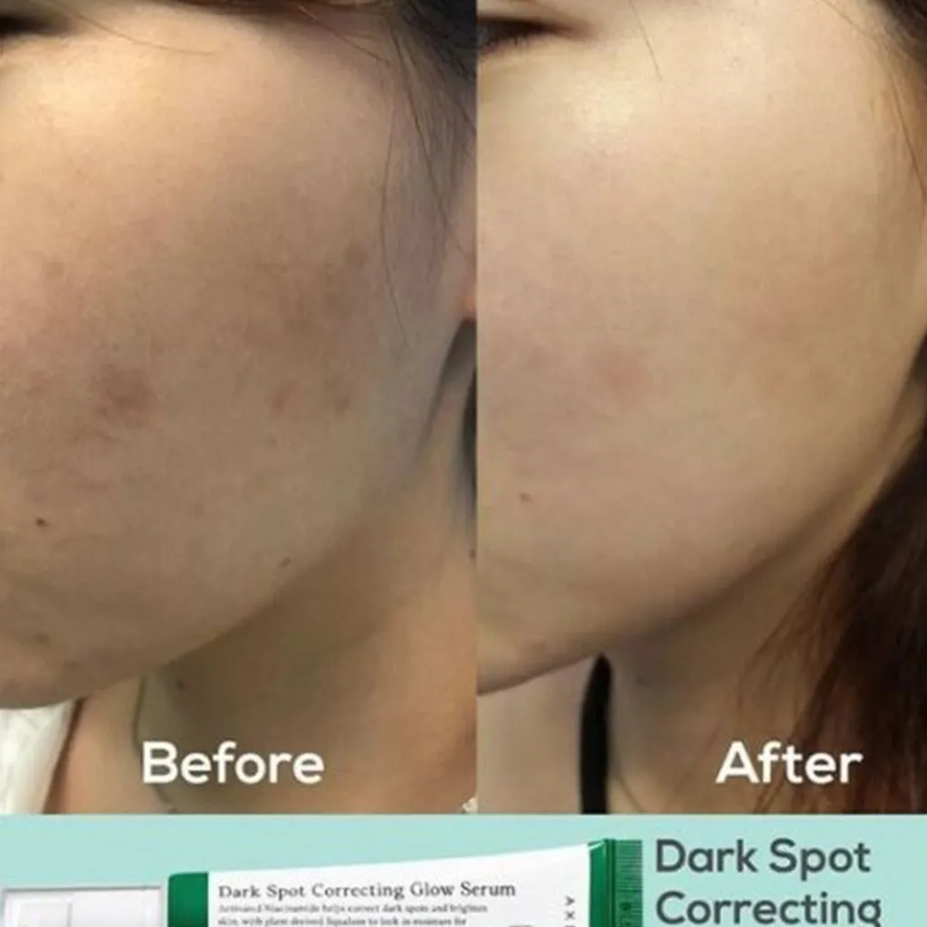 Axis-Y Dark Spot Correcting Brighten   Moisturize Glow Facial Serum 50ml